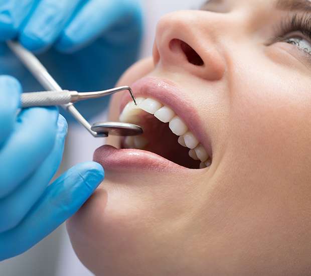 Sylva Dental Bonding