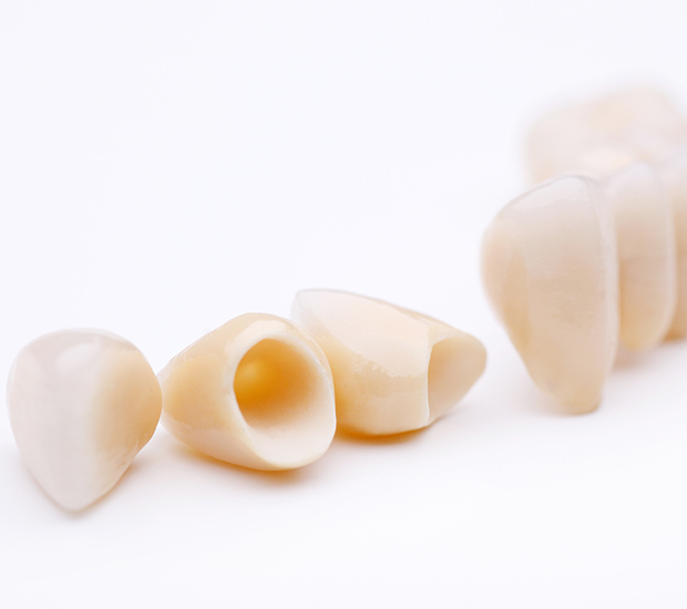 Sylva Dental Crowns and Dental Bridges