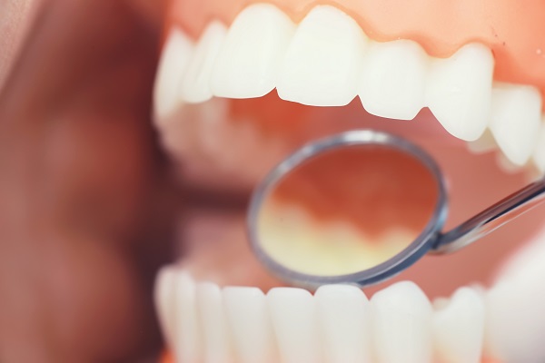 What Happens During A Full Mouth Reconstruction?