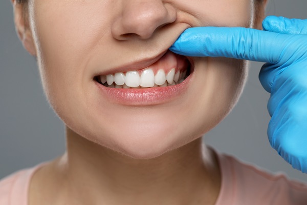 Can Gum Disease Be Cured?