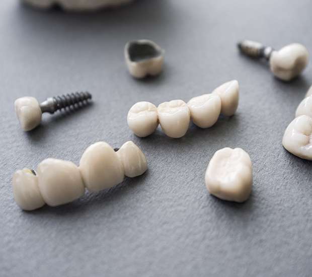 Sylva The Difference Between Dental Implants and Mini Dental Implants
